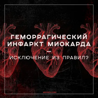 Что такое инфаркт миокарда? Когда его можно заподозрить и что делать? |  Всего понемногу: о медицине и вокруг неё | Дзен