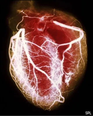 Симптомы и первая помощь при инфаркте - enableme.org.ua