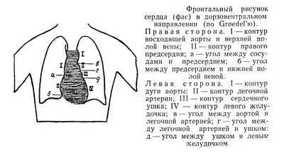 11 признаков того, что у вас может случиться остановка сердца - Лайфхакер