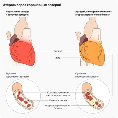 Аускультация сердца, легких, живота – правила и точки выслушивания