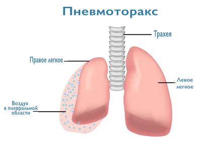 Причины боли в груди