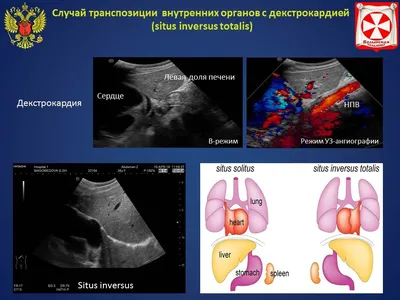 In Vivo Surface Electrocardiography for Adult Zebrafish | Protocol  (Translated to Russian)