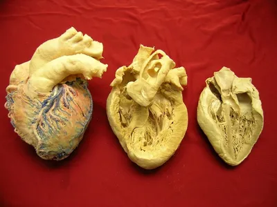 Международный морфологический центр AN-6 Сердце в разрезе