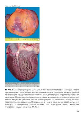 Сердце простой рисунок анатомия (48 фото) » Рисунки для срисовки и не только