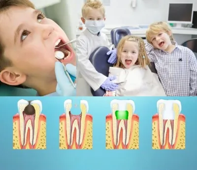 Лечение зубов детям - Стоматология в Краснодаре