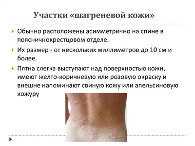 Med Nail on Instagram: \"Туберозный склероз (болезнь Бурневилля) — редкое  генетическое заболевание, при котором во множестве органов и тканей  образуются доброкачественные опухоли. Полисистемный характер нарушений  порождает широкий спектр симптомов ...