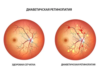 семинар 5 литра | PDF