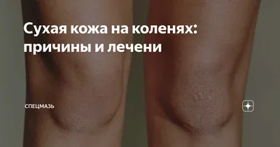 Сухая кожа на коленях: причины и лечени | Спецмазь | Дзен