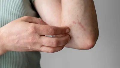 Повреждение кожи ноги: причины, симптомы и методы лечения