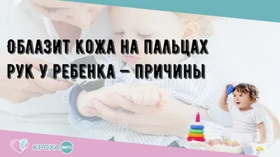 Облазит кожа на пальцах рук у ребенка — причины - YouTube