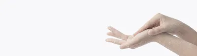 Детская клиника Европейского Медицинского Центра - Трещинки на пальчиках рук  и ног у детей - кто сталкивался? Причин этому не страшному, но неприятному  недугу масса: контактные дерматиты, вирусные инфекции, хронические  дерматозы (включая