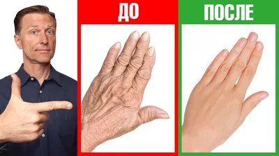Цыпки на руках: о симптомах и профилактике холодового дерматита |  OmniusClinic | Дзен