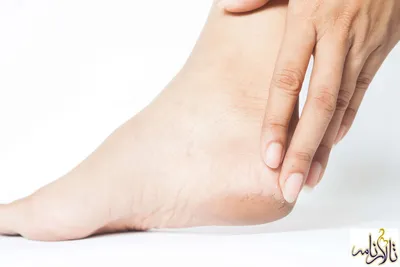 Сухая кожа на ногах: причины и что делать с сухостью — EVO Laboratoires