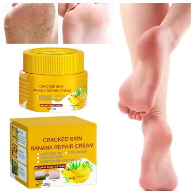 Крем для ног Healthys, крем для удаления треснувшей кожи, бананов, для  ремонта, натуральные успокаивающие кремы для ног, для чрезвычайно детского  питания, массажа ног | AliExpress