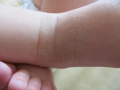 От чего шелушится кожа у новорожденного? | Батя в шоке | Дзен