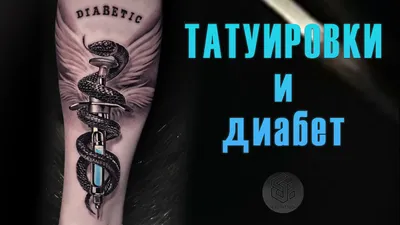 Аллергия на татуировки | VER SACRUM TATTOO | Дзен