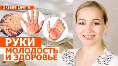 Как сохранить молодость рук? Кожа сохнет, шелушится на руках!» — Яндекс Кью