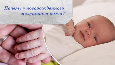 Почему у новорожденного ребенка шелушится кожа на теле? | Мама и малыш |  Дзен
