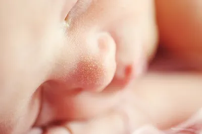 У новорожденного шелушится кожа — что делать и не опасно ли?