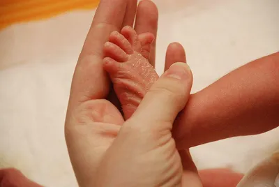 Шелушится кожа у новорожденного: что делать, если у младенца облазит кожа