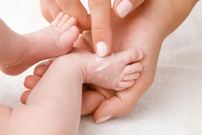 Сухая кожа у новорожденного — причины сухости кожи лица и тела у грудничка,  что с этим делать