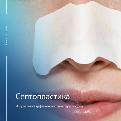 Искривление перегородки носа (деформация) - диагностика и лечение в Москве.  Консультация врача.