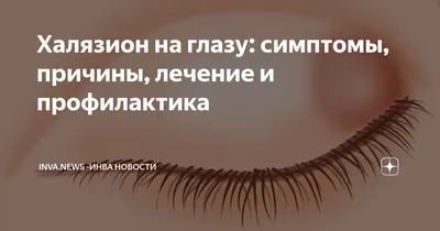 Мазь глазная ОАО \"Синтез\" Гидрокортизон - «На глазу халязион? Тебе поможет  гидрокортизон!» | отзывы