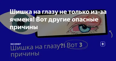 Глазная клиника Федоровой Ирины Святославны - Пингвекула – это  доброкачественное уплотнение слизистой оболочки, покрывающей глазное яблоко  (конъюнктивы). Пингвекулы могут появиться в любом возрасте, но в основном  возникают у пожилых людей. В большинстве