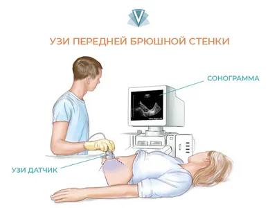 Сперматоцеле: Киста придатка яичка у мужчин - лечение в Украине | Клиника  Биляка