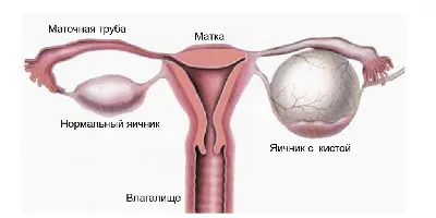 Лимфаденит: причины, симптомы, препараты для лечения в - МИС Аптека 9-1-1