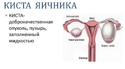 Почему образуются вагинальные прыщи?