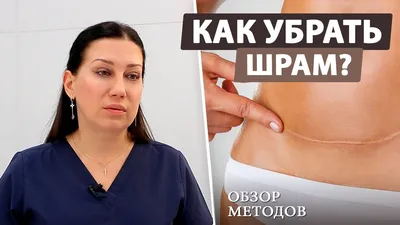 Удаление гемангиом у взрослых и детей в Киеве ▷ Клиника NeoVita