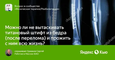 «Нога стала на 1,5 см короче»: мужчина судится с травматологами из-за  неправильно вылеченного перелома | Медицинская Россия