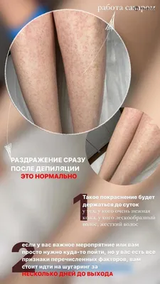 Шугаринг - это очень больно!