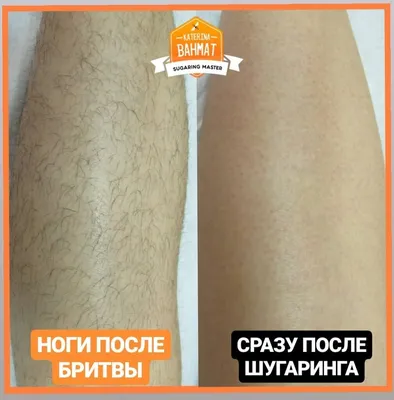 Шугаринг ног в Москве — 4453 мастера шугаринга, 521 отзыв, цены и рейтинг  на Профи