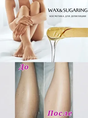 Лазерная эпиляция ног с помощью LightSheer DUET — Сеть косметологических  клиник Эпилайк