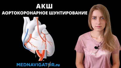 Аортокоронарное шунтирование сердца и сосудов - MedTour