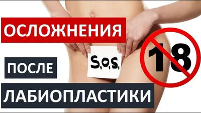 Как вы будете чувствовать себя после уменьшения груди (редукционной  мастопексии)