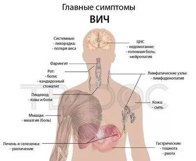 ВИЧ-инфекция: проявления в области рта при СПИДеDENTALMAGAZINE.RU