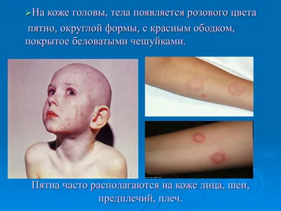 https://health.sb.by/articles/kardiolog-rasskazala-o-skrytykh-priznakakh-serdechno-sosudistykh-zabolevaniy.html