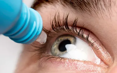 Синдром сухого глаза: как лечить? - YouTube