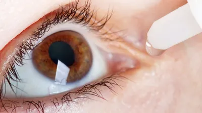 Как подобрать линзы для сухих глаз