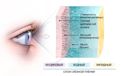 Лечение синдрома сухого глаза