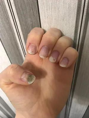 Юлия Nail-master - Синегнойная палочка или псевдомония – это бактерия,  которая при обычной температуре широко присутствует в почве и воде. Она  всегда есть во влажных помещениях в том или ином количестве. Наиболее