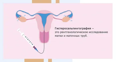 Лонгидаза 3000МЕ супп ваг/рект №10 | Желудочно-кишечные средства |  Интернет-аптека Фармация