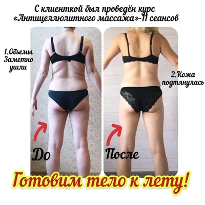 Beauty Cups Вакуумная банка для антицеллюлитного массажа тела D-50 мм.