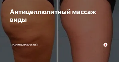 Антицеллюлитный массаж как делать в домашних условиях? Все правда о  процедуре - Чемпионат