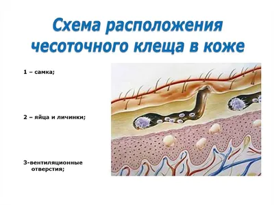 Соколова 2017 ДЕРМАТОСКОПИЯ - НЕИНВАЗИВНЫЙ МЕТОД ДИАГНОСТИКИ И ОЦЕНКИ  ЭФФЕКТИВНОСТИ ЛЕЧЕНИЯ ЧЕСОТКИ