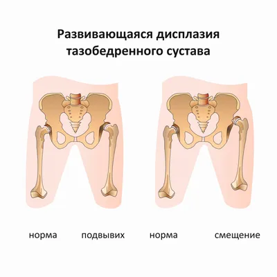 Перианальный дерматит - причины, симптомы, диагностика, лечение и  профилактика