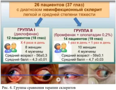 Рисунок 6. Группы сравнения терапии склеритов.